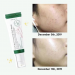 Axis-Y Dark Spot Serum